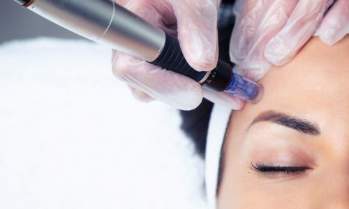 Shot,Of,Cosmetologist,Making,Mesotherapy,Injection,With,Dermapen,On,Face